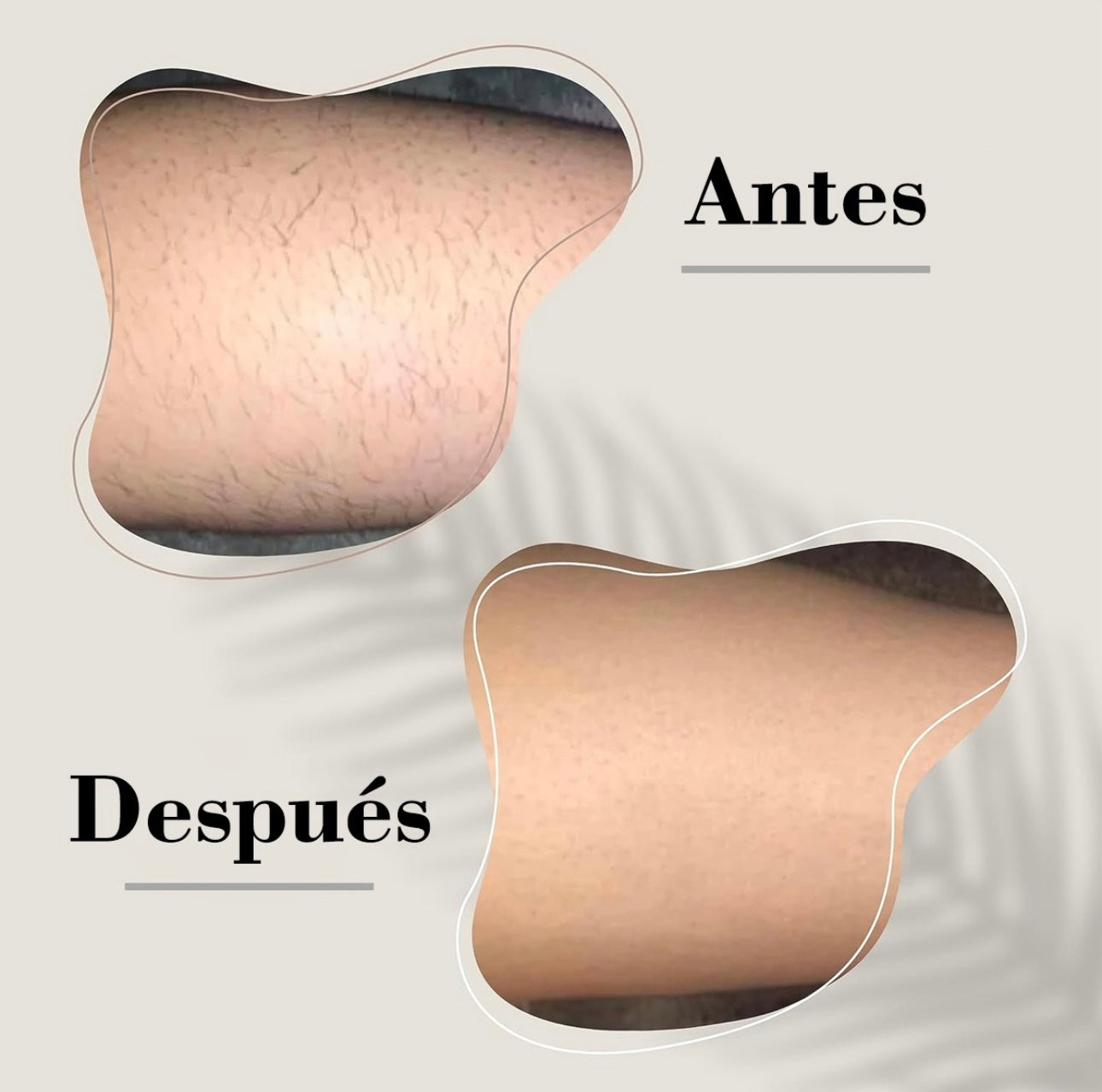 Depiladora láser IPL